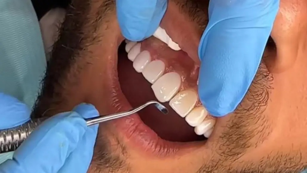 Los tratamientos dentales evolucinan con la tecnología